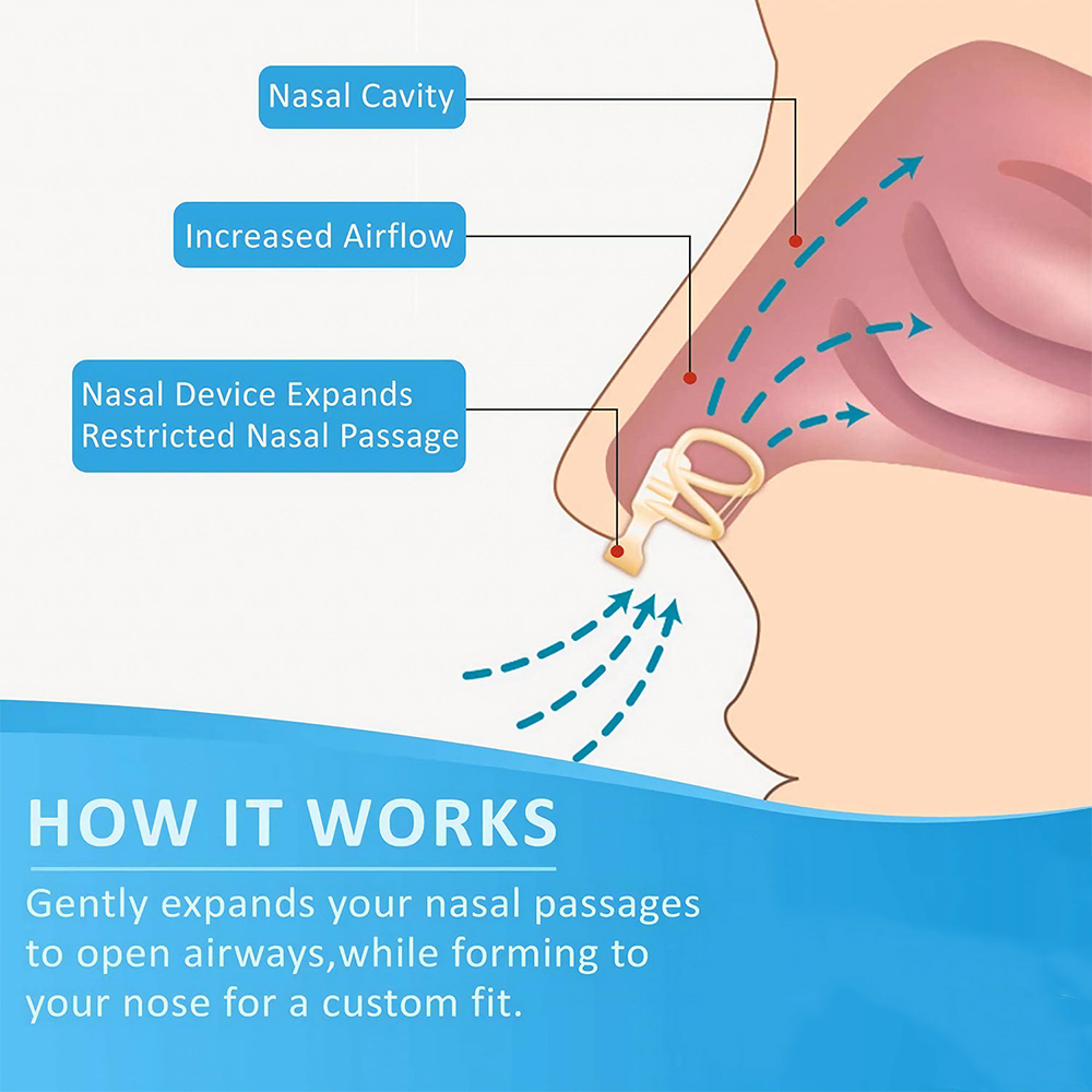Dilatatore nasale con tappo pe - Anti Snore Contour Pillow recensione e prezzo